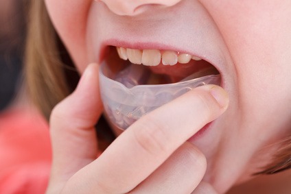 Protecting Your Teeth During Sports and Activities
