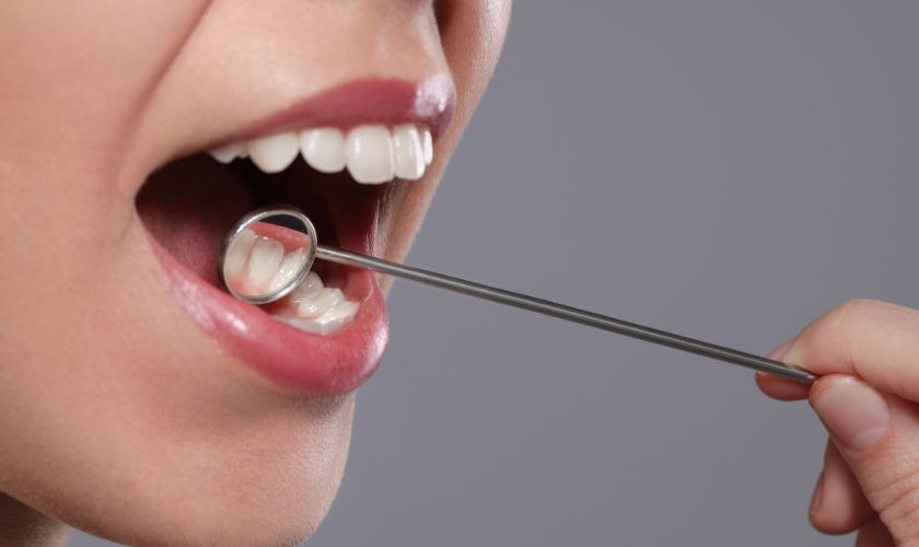 oral cancer screening